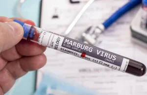 Марбург вирусының өршуі: Қазақстанның бас санитария дәрігері мәлімдеме жасады